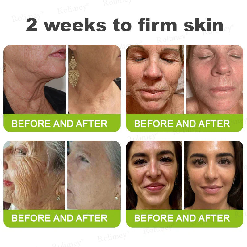 Creme firmador e antirrugas Rolimey® Botox & Vita-A Retinol Shot - Último dia da promoção com 70% de desconto
