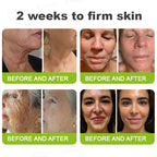 Creme firmador e antirrugas Rolimey® Botox & Vita-A Retinol Shot - Último dia da promoção com 70% de desconto