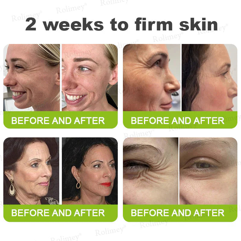 Creme firmador e antirrugas Rolimey® Botox & Vita-A Retinol Shot - Último dia da promoção com 70% de desconto