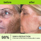 Creme firmador e antirrugas Rolimey® Botox & Vita-A Retinol Shot - Último dia da promoção com 70% de desconto