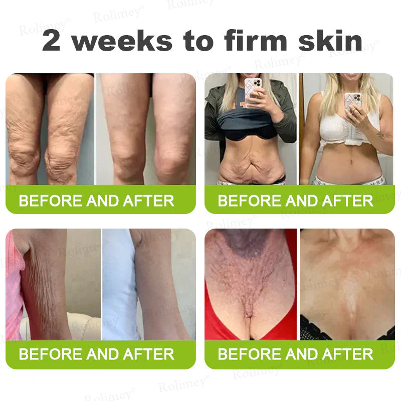 Creme firmador e antirrugas Rolimey® Botox & Vita-A Retinol Shot - Último dia da promoção com 70% de desconto