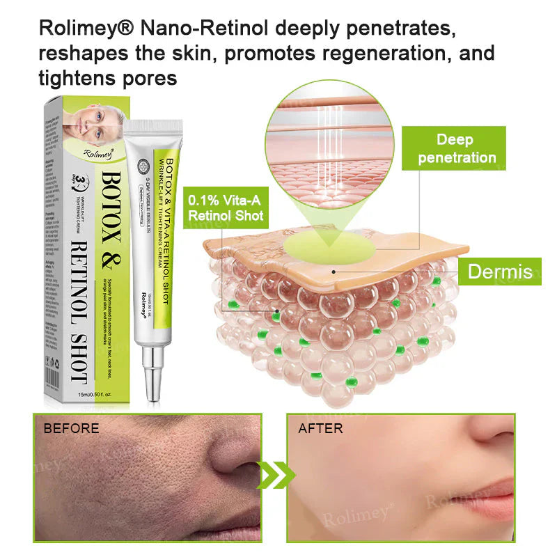 Creme firmador e antirrugas Rolimey® Botox & Vita-A Retinol Shot - Último dia da promoção com 70% de desconto