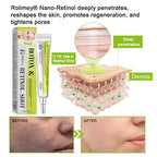 Creme firmador e antirrugas Rolimey® Botox & Vita-A Retinol Shot - Último dia da promoção com 70% de desconto