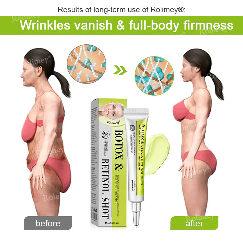 Creme firmador e antirrugas Rolimey® Botox & Vita-A Retinol Shot - Último dia da promoção com 70% de desconto