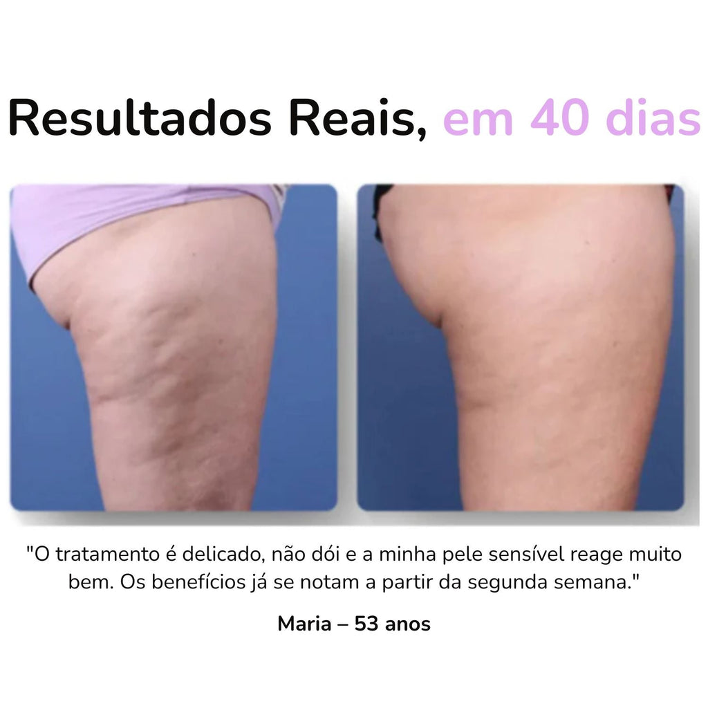 Massageador Anticelulite Pro + 2 Óleos  de brinde