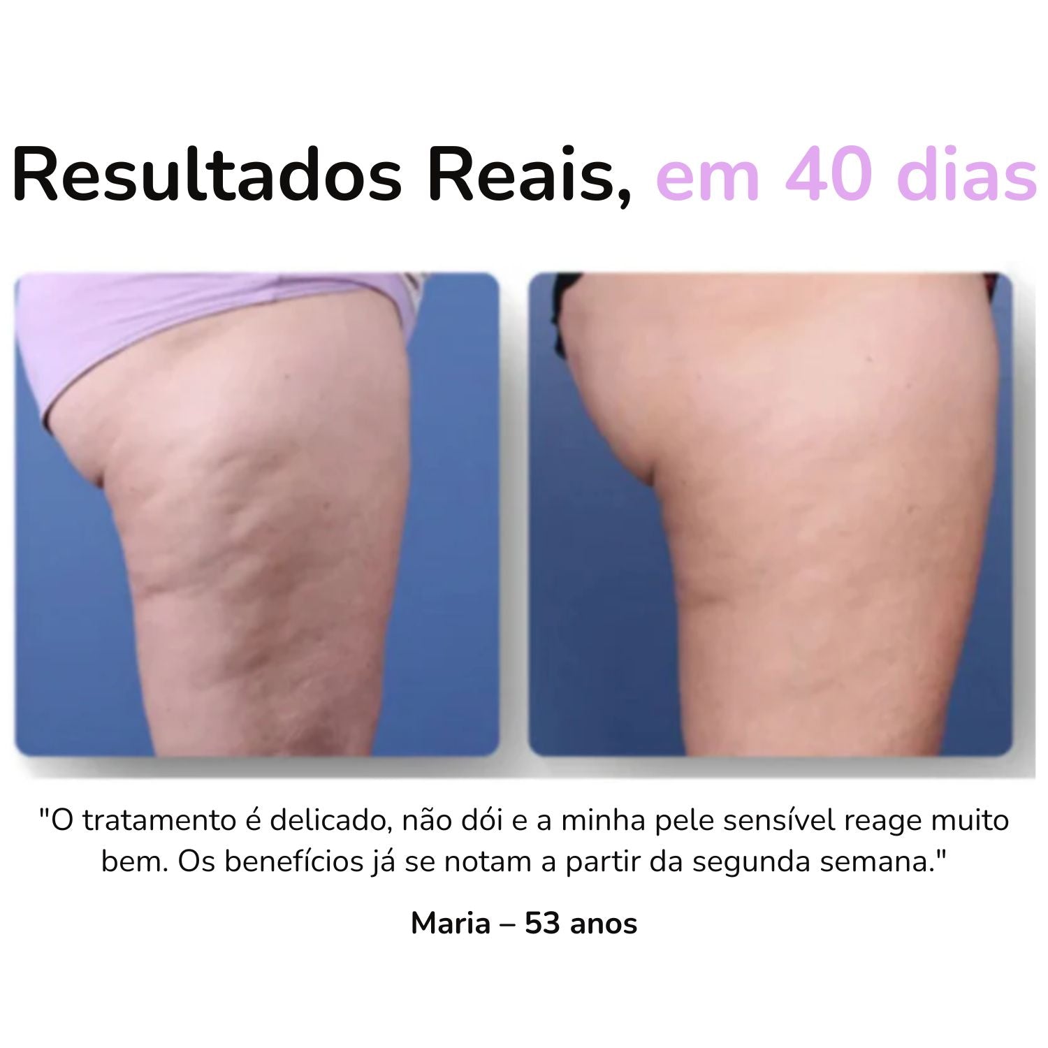 Massageador Anticelulite Pro + 2 Óleos  de brinde